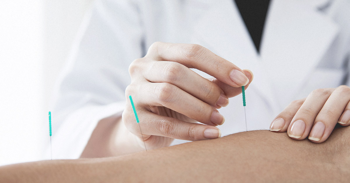 What Are The Benefits Of Dry Needling Therapy Rbh Health